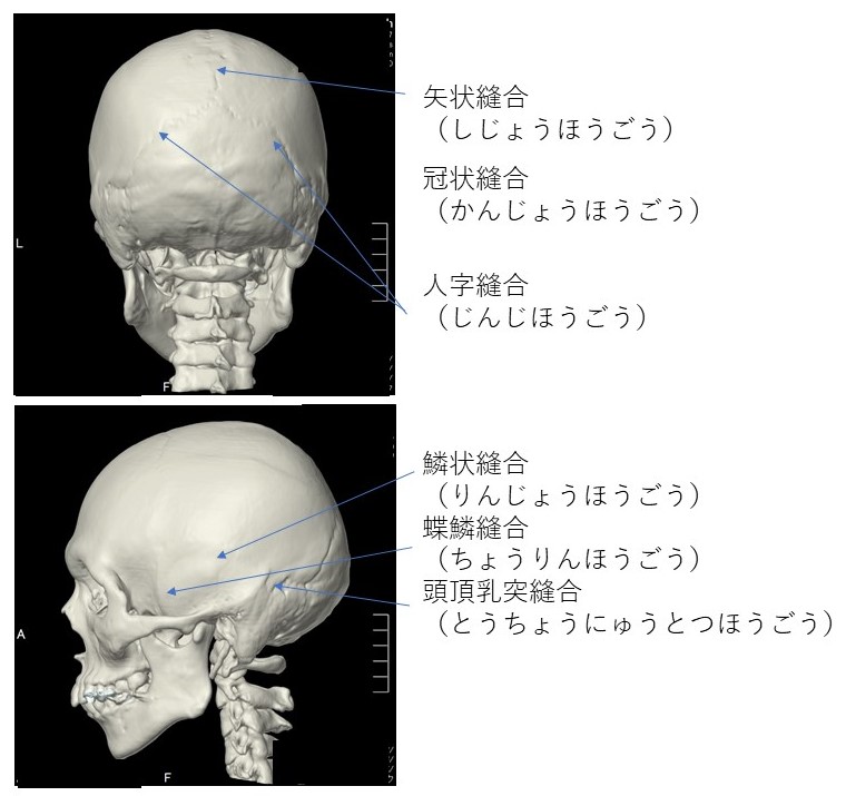 画像診断 頭蓋骨 名古屋 春日井の脳神経外科 勝川脳神経クリニック