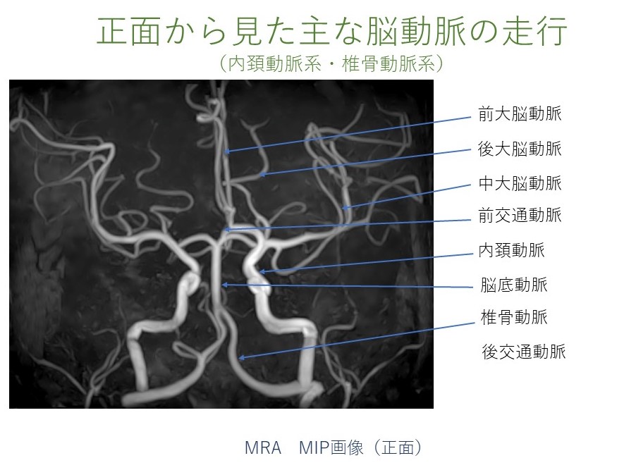 画像診断 脳血管 名古屋 春日井の脳神経外科 勝川脳神経クリニック