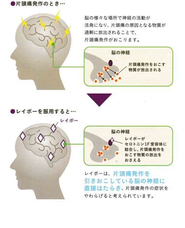 レイボー錠 片頭痛発作の急性期治療薬 名古屋 春日井の脳神経外科 勝川脳神経クリニック
